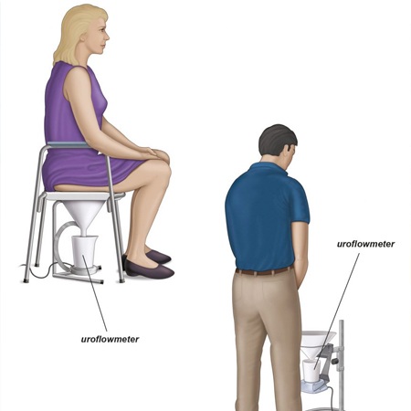 Uroflowmetry Meerut